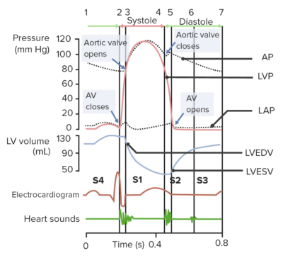 Heart Sounds | Concise Medical Knowledge