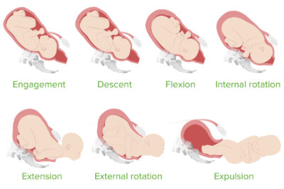 Normal And Abnormal Labor | Concise Medical Knowledge