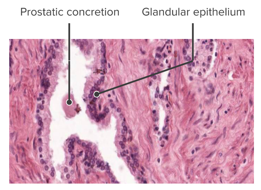 The glandular columnar epithelium of the prostate gland (histological)