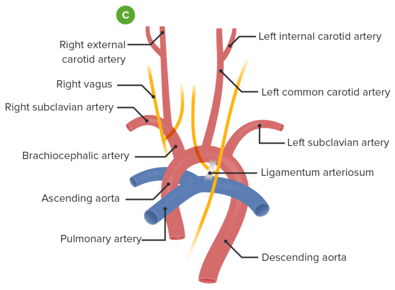 Vascular Rings | Concise Medical Knowledge