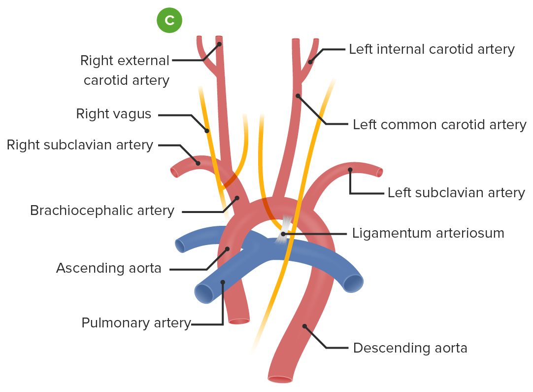 The great arteries in the adult