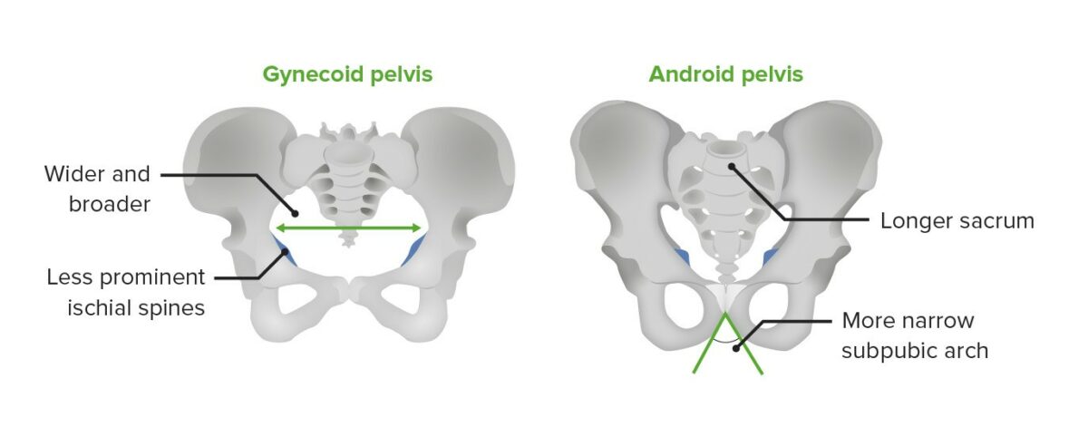 The gynecoid pelvis versus the android pelvis