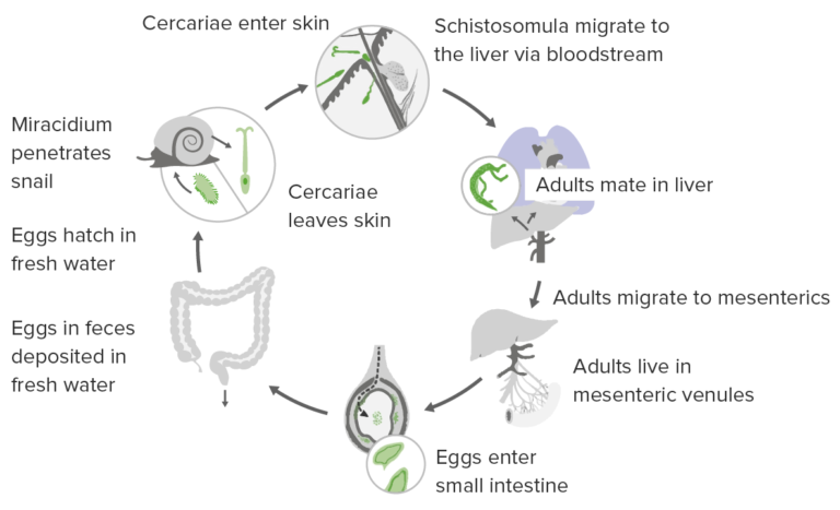 Schistosoma/Schistosomiasis | Concise Medical Knowledge