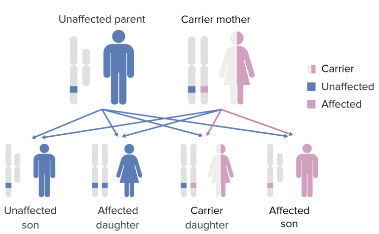 X-linked Agammaglobulinemia | Concise Medical Knowledge