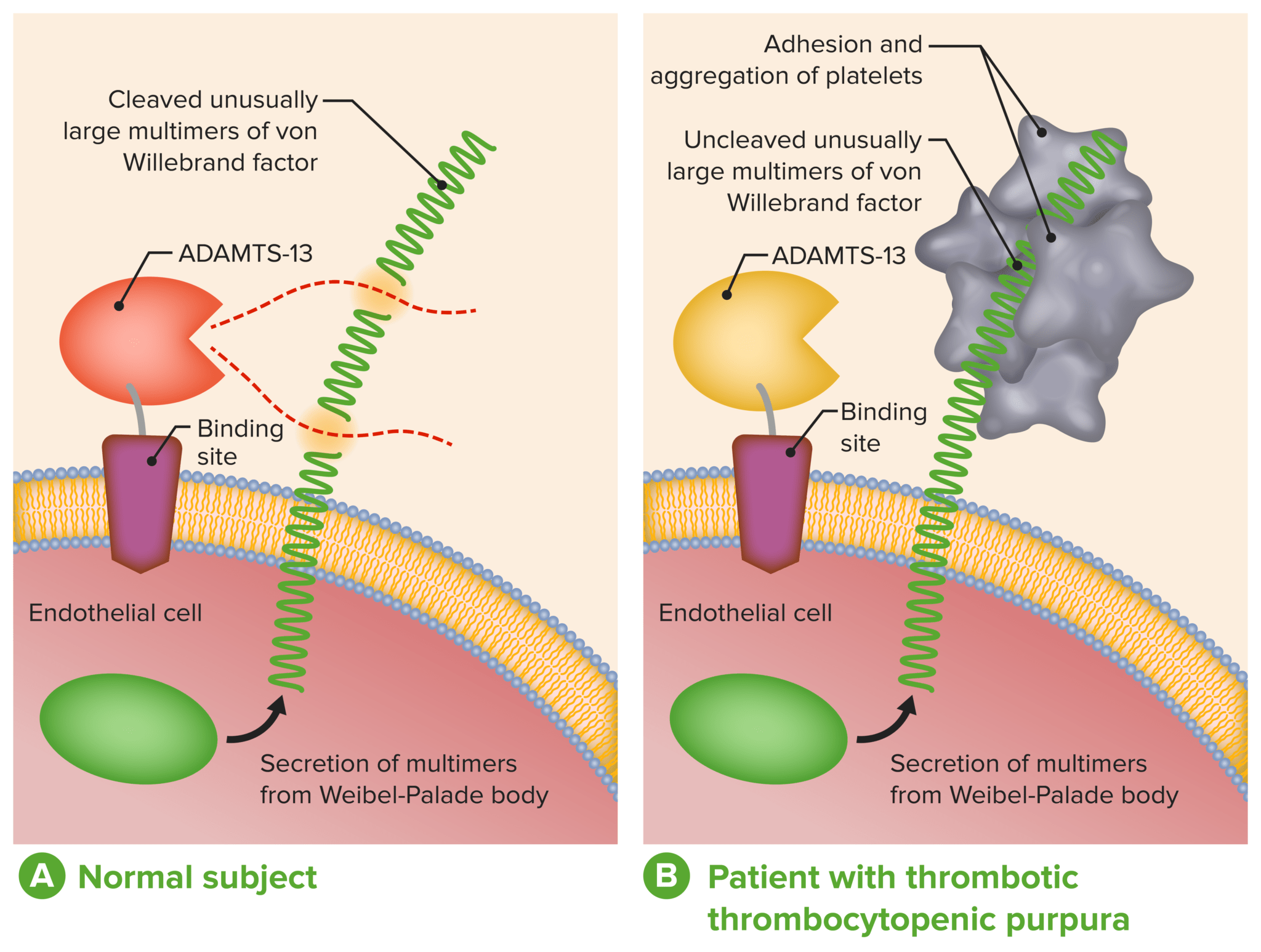 Thrombotic Thrombocytopenic Purpura | Concise Medical Knowledge