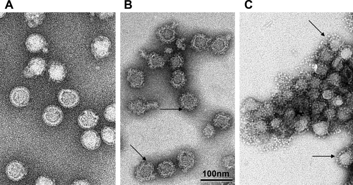 Tick-borne encephalitis virus flaviviridae