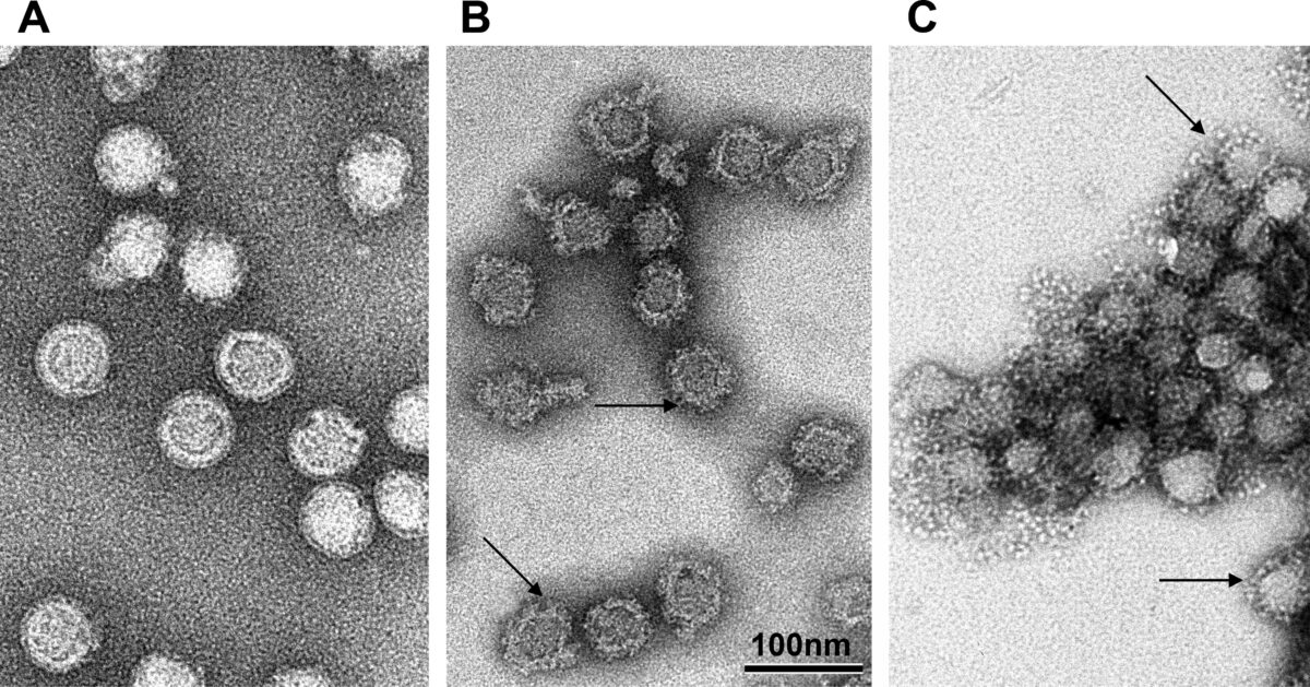 Vírus da encefalite transmitida por carrapatos flaviviridae