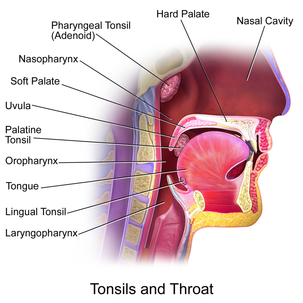 Tonsils in the oropharyngeal area and nasopharynx