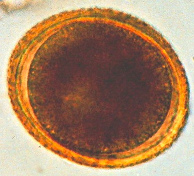 Toxocara ("roundworm")