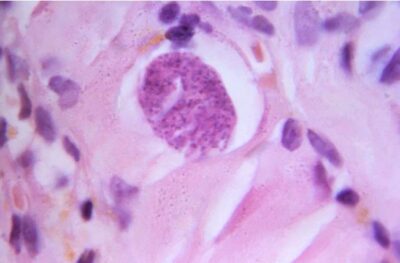 Toxoplasma gondii protozoan tissue cyst