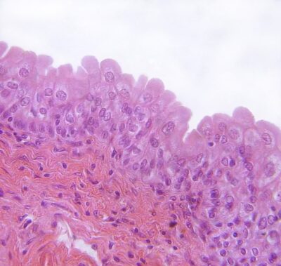 Surface Epithelium: Histology | Concise Medical Knowledge