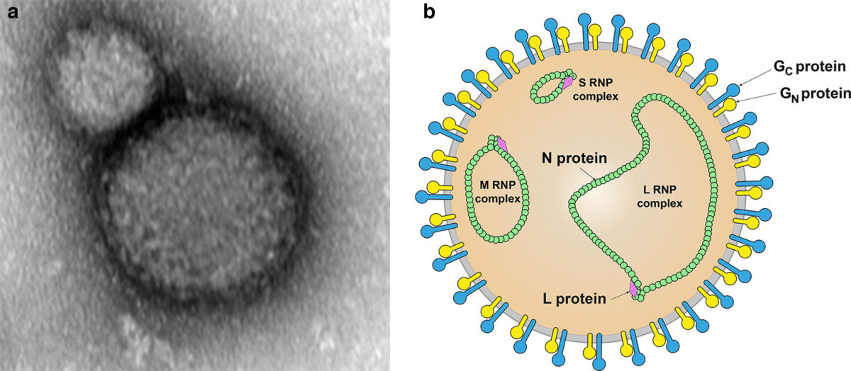 Transmission electron micrograph Crimean-Congo hemorrhagic fever virus Bunyavirus