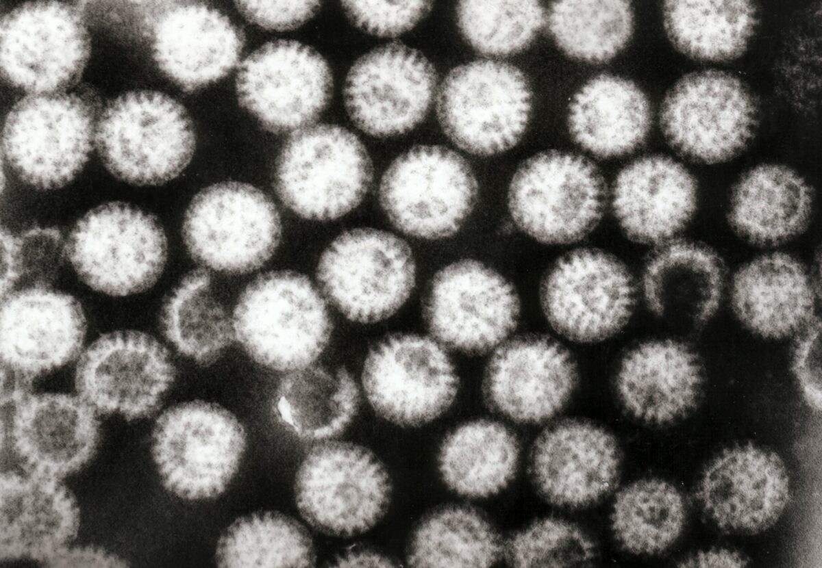 Micrografia eletrônica de transmissão de vários vírions de rotavírus