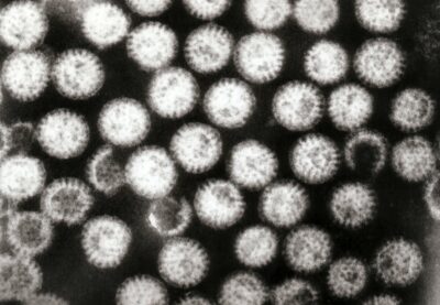 Transmission electron micrograph of multiple rotavirus virions
