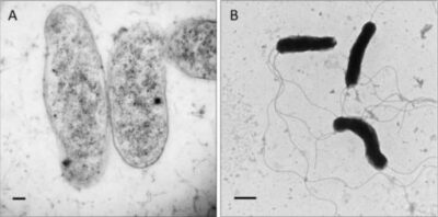 Bartonella | Concise Medical Knowledge