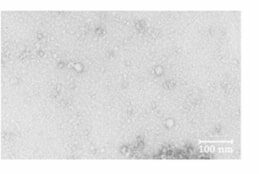 Imagem de microscópio eletrônico de transmissão de norovírus murino não tratado