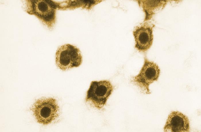 Transmission electron microscopic image cytomegalovirus