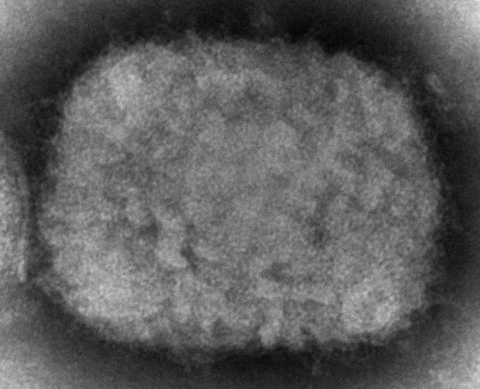 Transmission electron microscopic image monkeypox virion orthopoxvirus