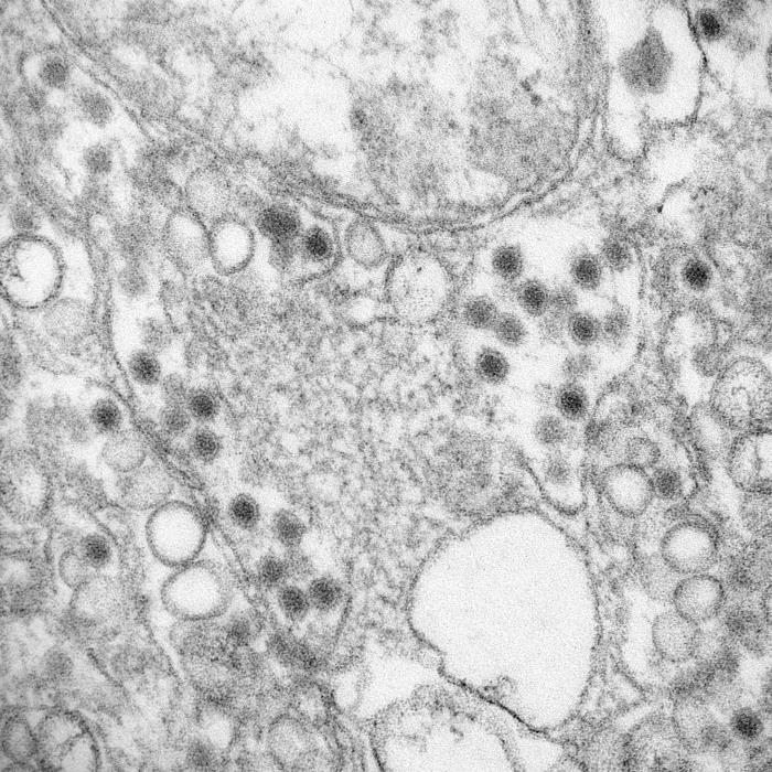 Transmission electron microscopic image of zika virus