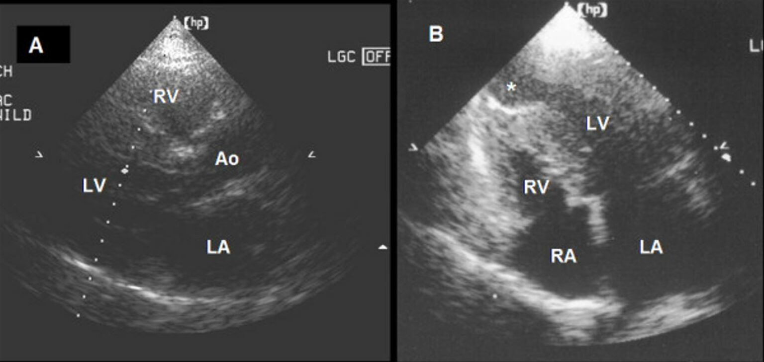 Imaging Of The Heart And Great Vessels Concise Medical Knowledge