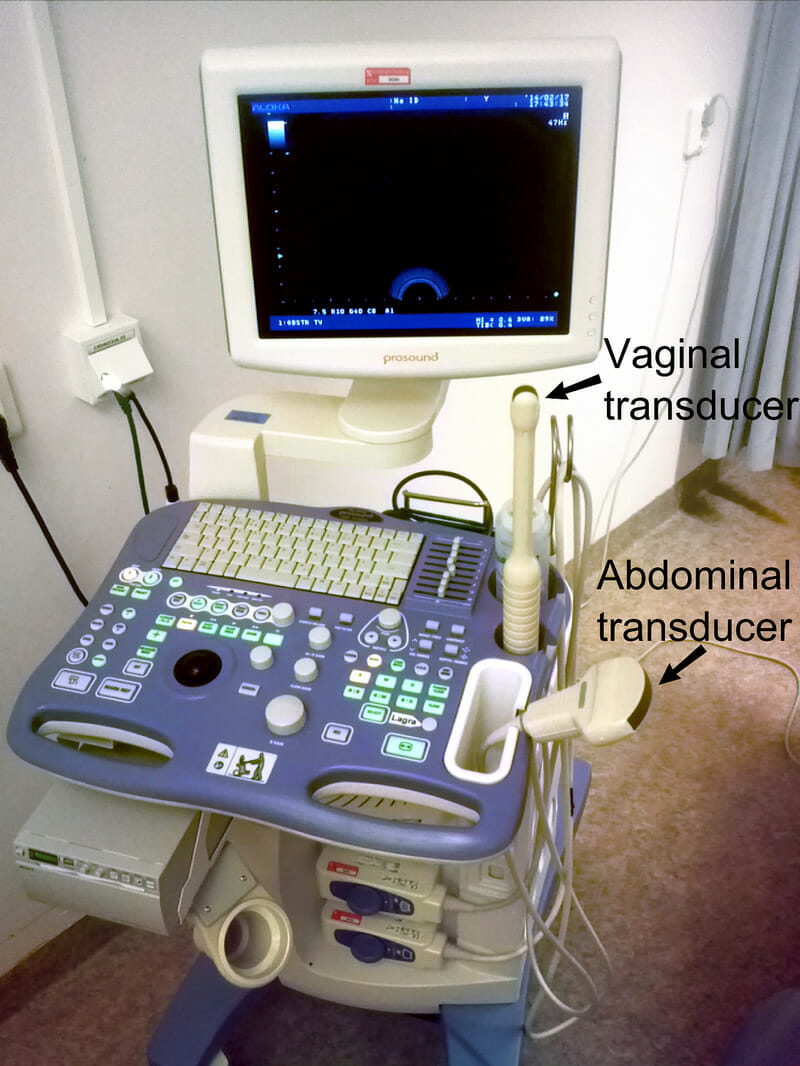 Transvaginal_ultrasonography_device