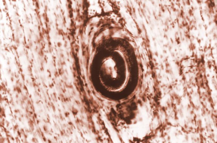 Trichinella spiralis cyst