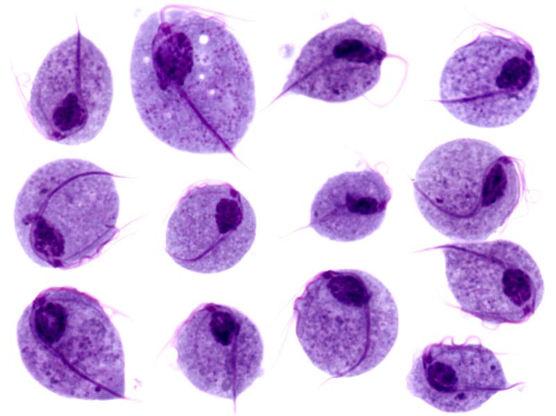 Trichomonas protozoa