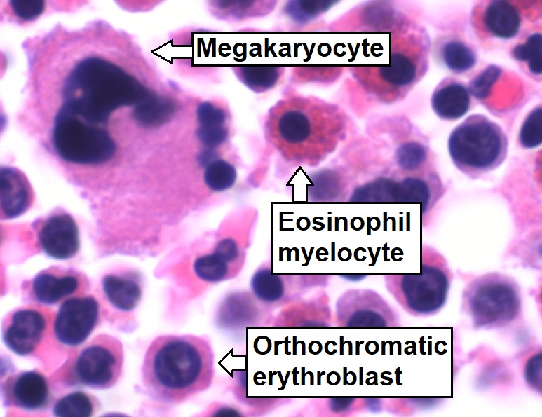 red blood cell microscope labeled