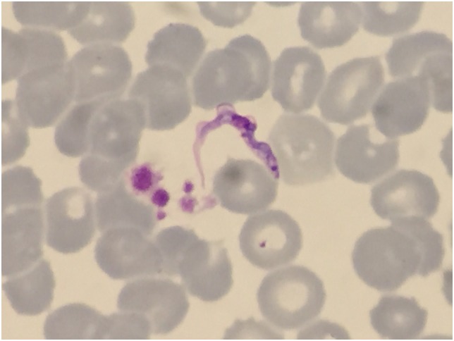 Tripanosomas en una gota fina de sangre teñida con giemsa