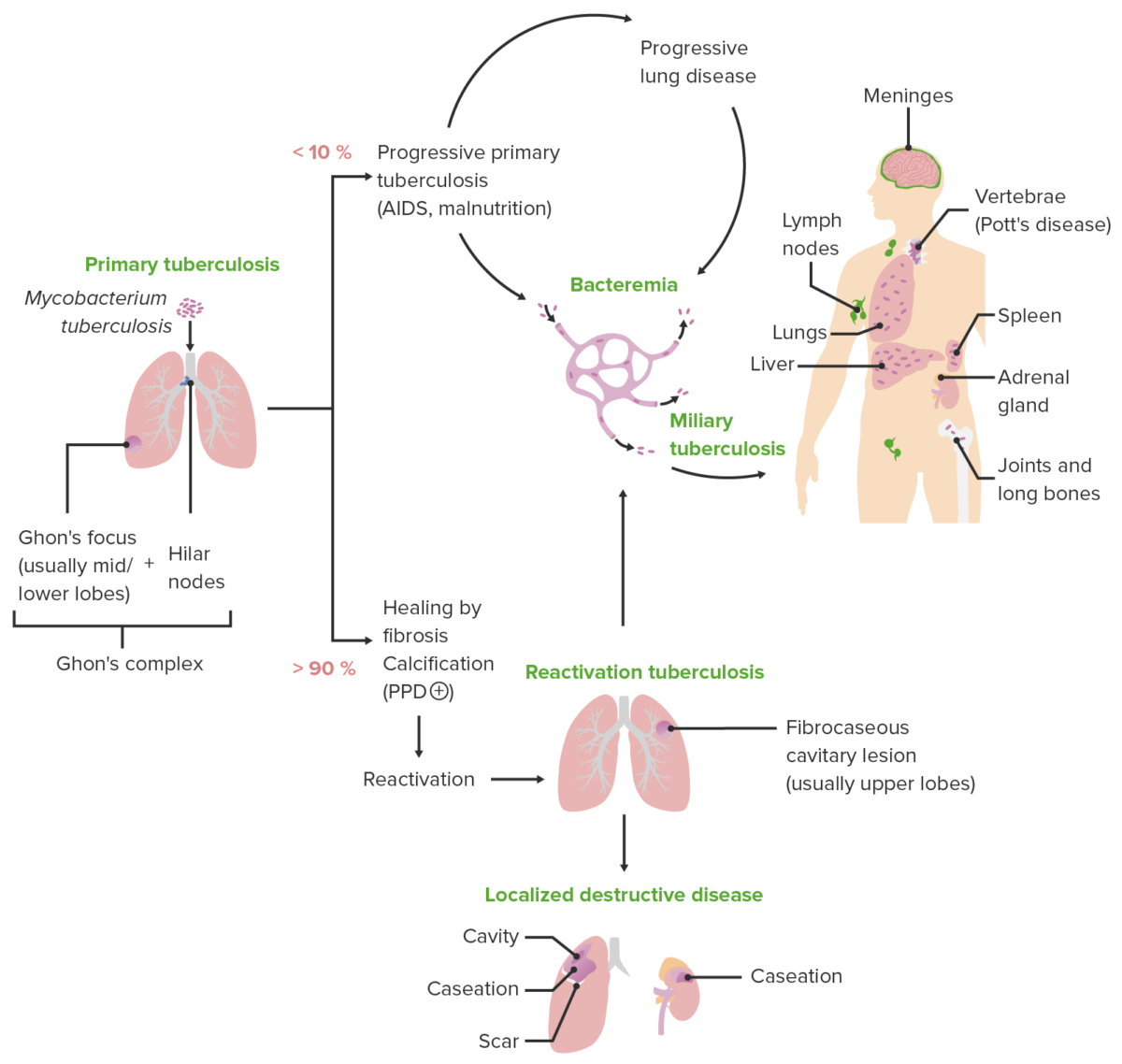 Apresentação clínica da tuberculose