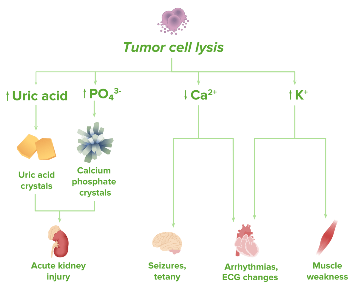 Tumor Lysis Syndrome Concise Medical Knowledge