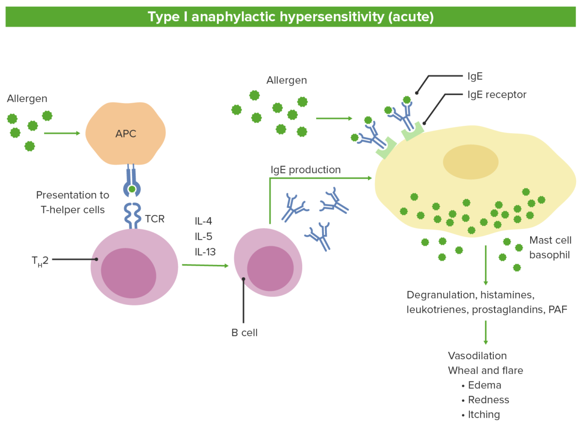 Type i anaphylactic hypersensitivity