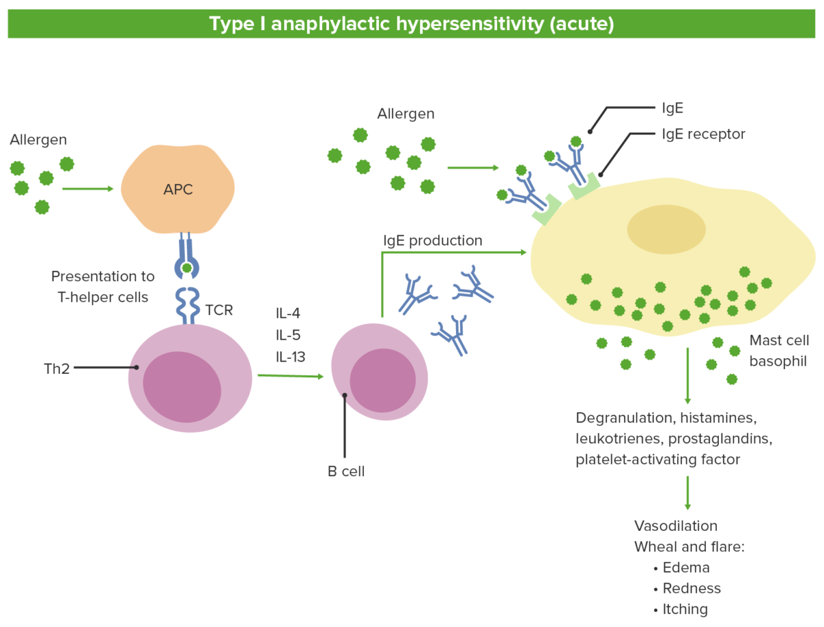 Type i anaphylactic hypersensitivity (acute)