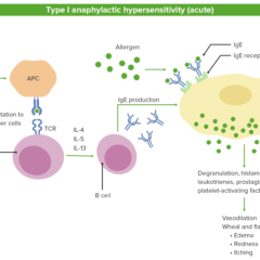 Type I anaphylactic hypersensitivity (acute)