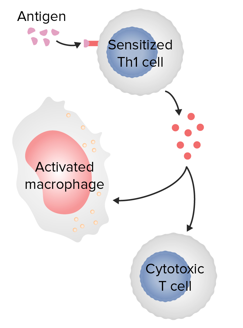 type 4 hypersensitivity case study