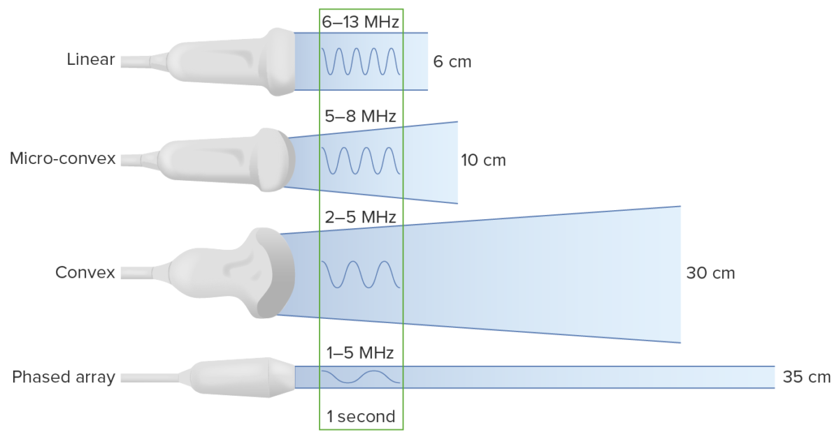 Different Types Of Ultrasound