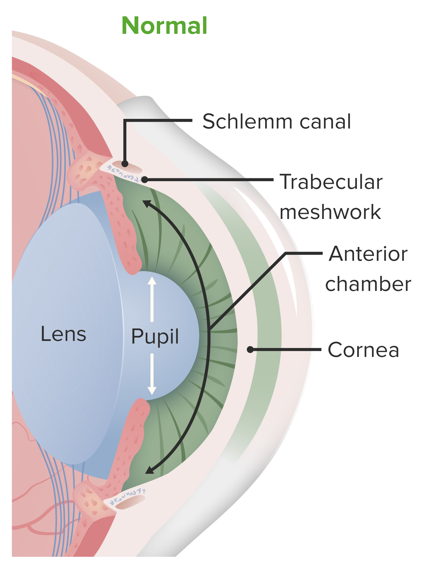 low angle glaucoma