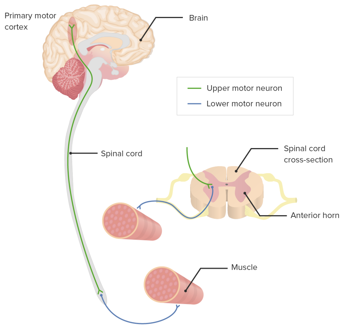 Umn vs lmn lesions