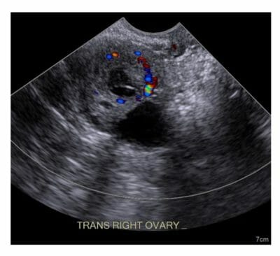 Gynecological Imaging | Concise Medical Knowledge