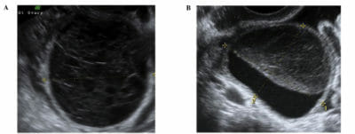 Gynecological Imaging | Concise Medical Knowledge