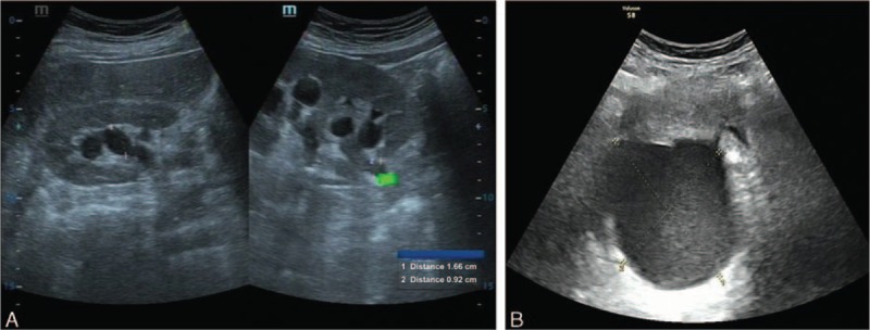 Urinary and gynecological ultrasound (sonography)