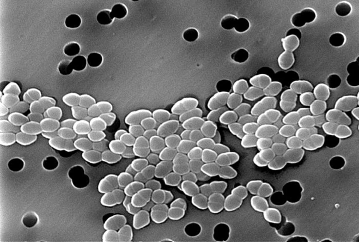 Enterococcus resistente a la vancomicina