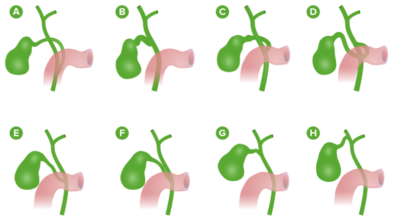 Gallbladder And Biliary Tract Anatomy Concise Medical Knowledge 4085