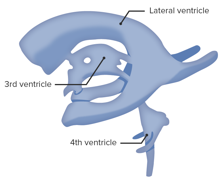Ventricular system isolated from brain