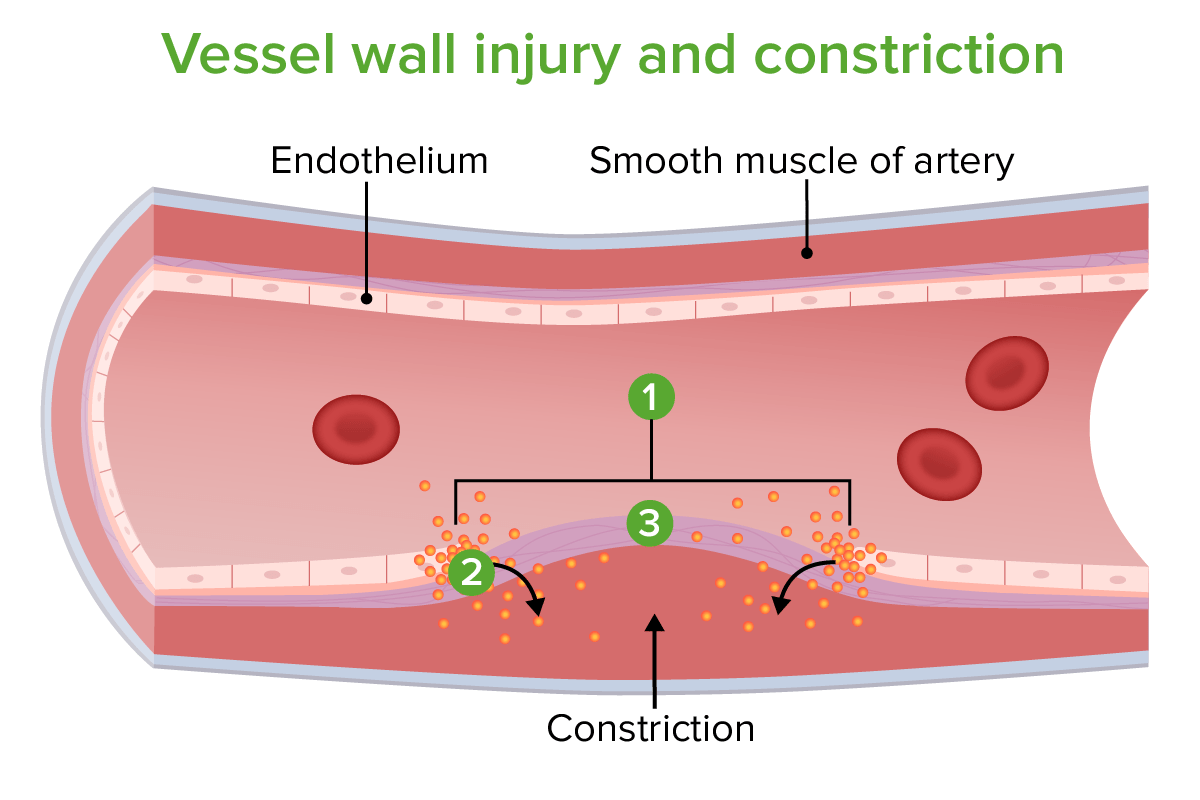 Vessel wall injury and constriction