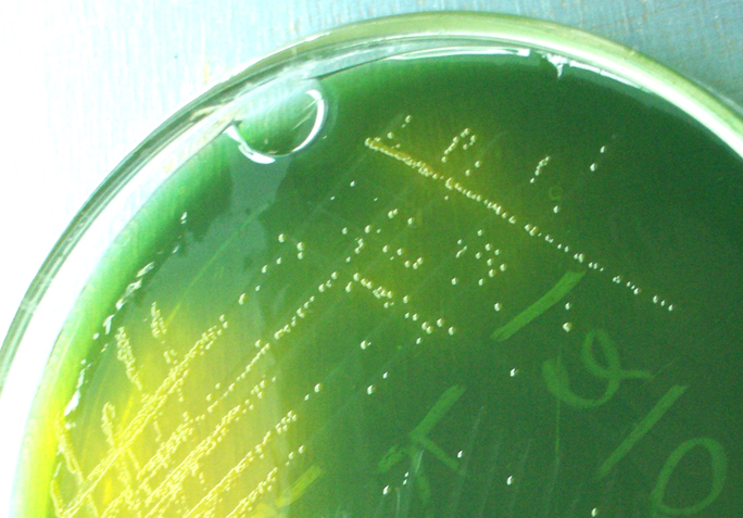 Vibrio cholerae on tcbs agar