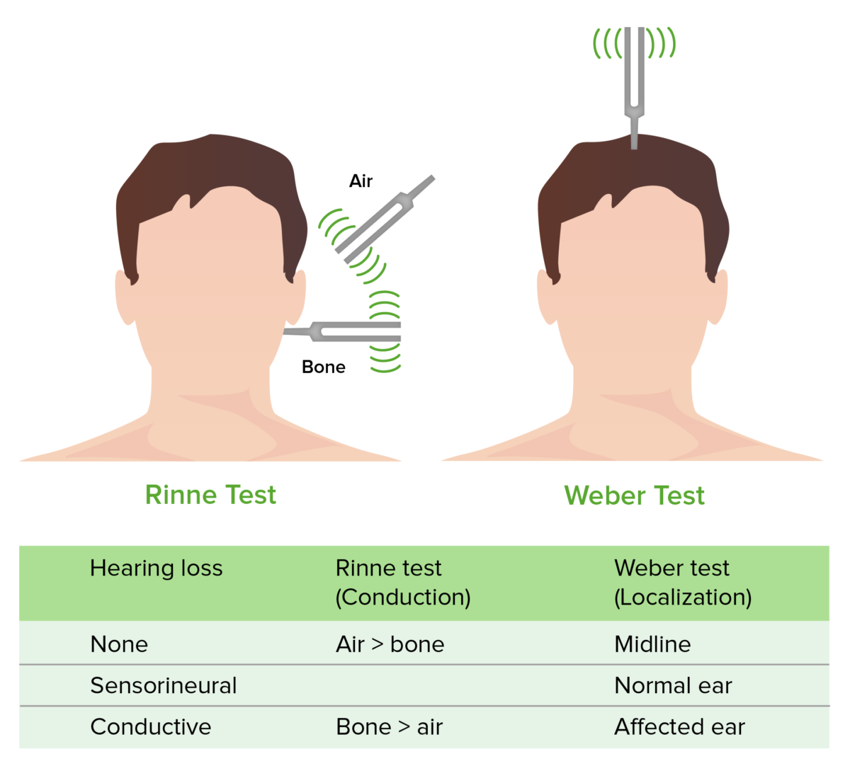 Rinne and weber tests