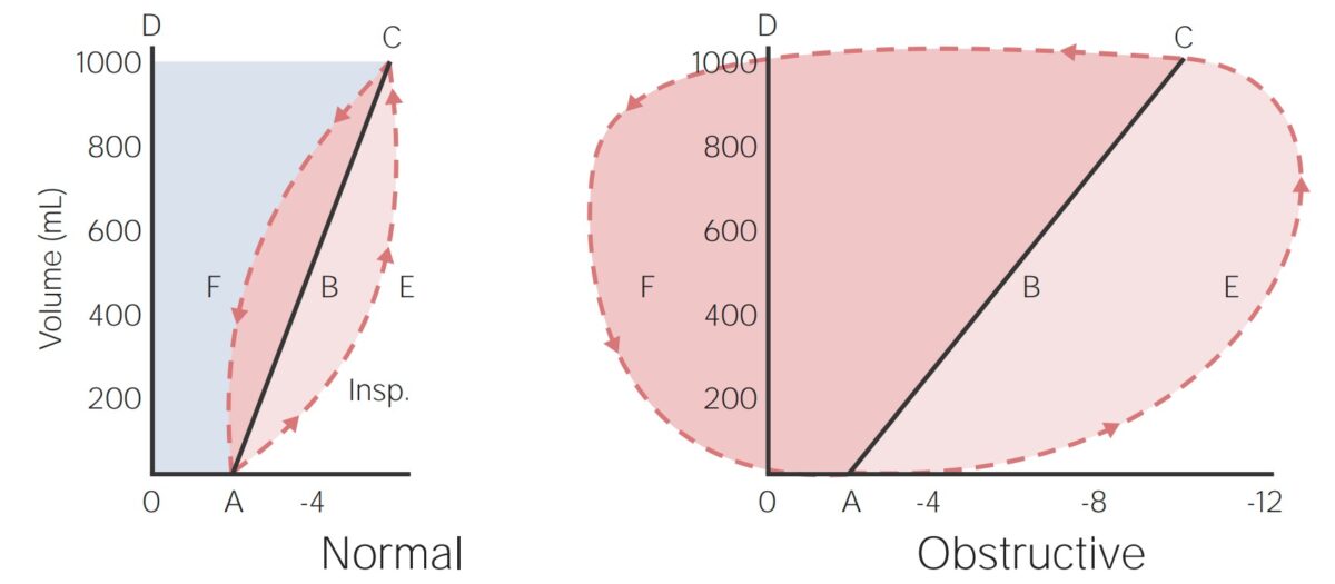 Ventilation Mechanics of Breathing Concise Medical Knowledge