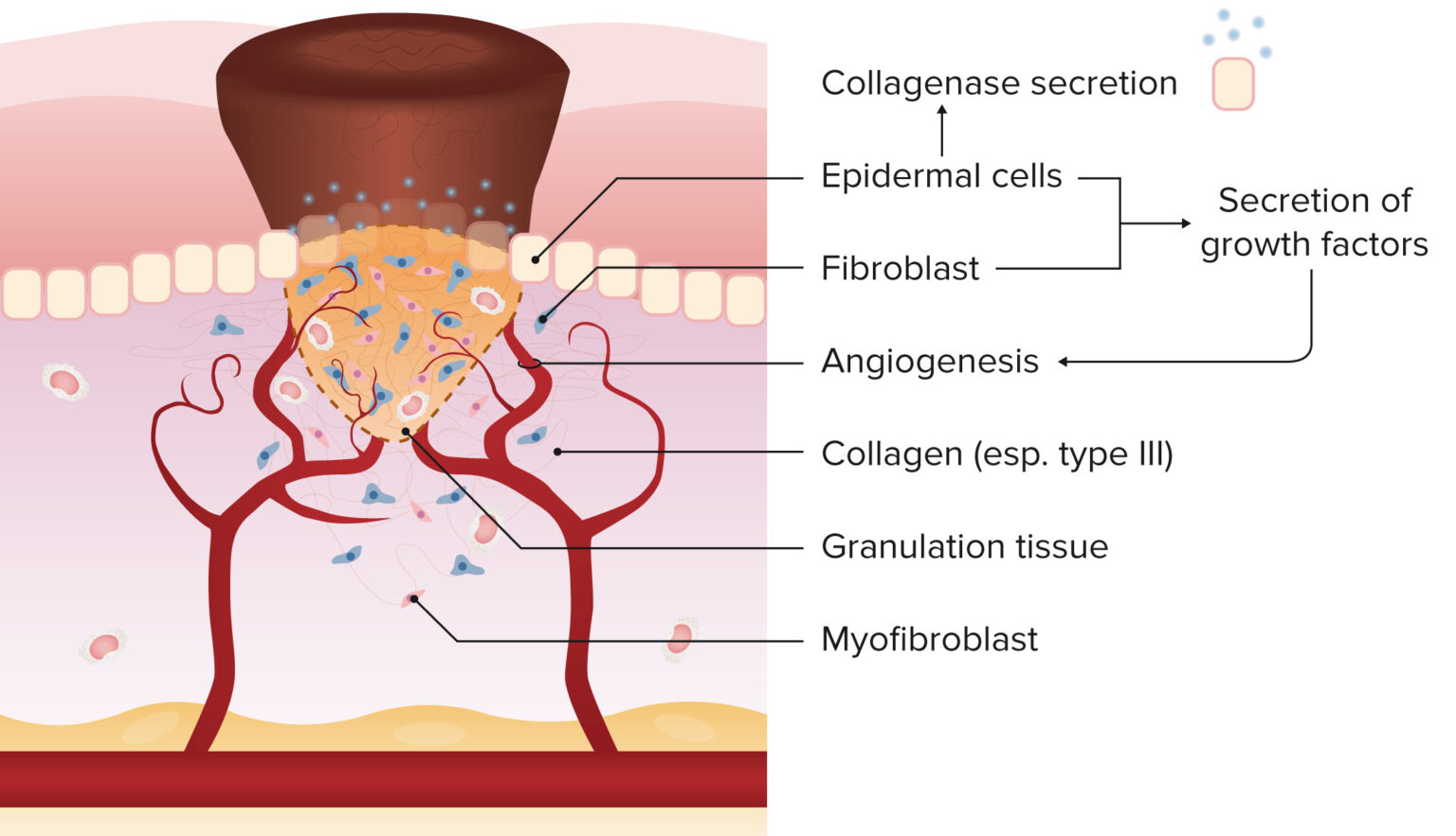 Wound Healing | Concise Medical Knowledge