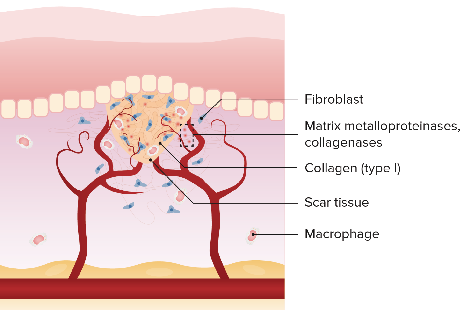 Wound Healing Process Diagram Wound Granulation Remodeling L